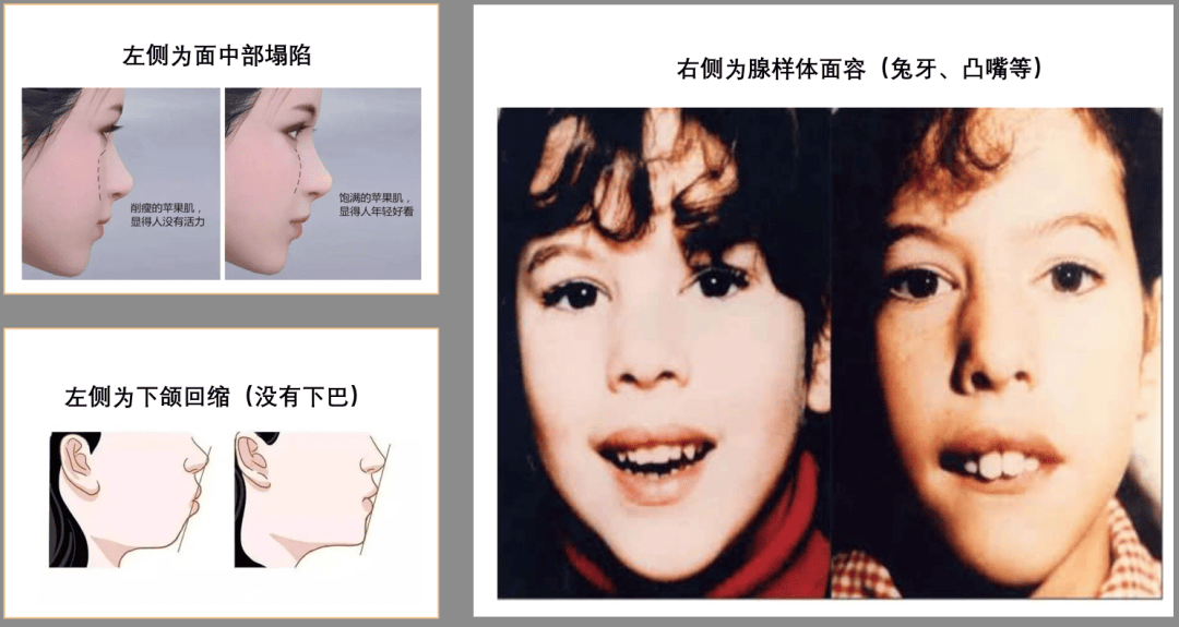 失调？反复感染？可能有简单的解决方法！尊龙凯时新版APP首页平衡力差？感统(图29)